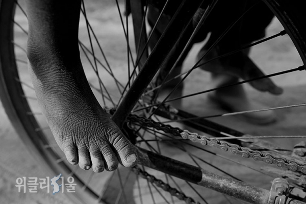 말라리아를 앓고 있는 어린이가 진료를 마치고, 아버지가 끄는 자전거를 타고 집으로 돌아가고 있다. ⓒ장영식